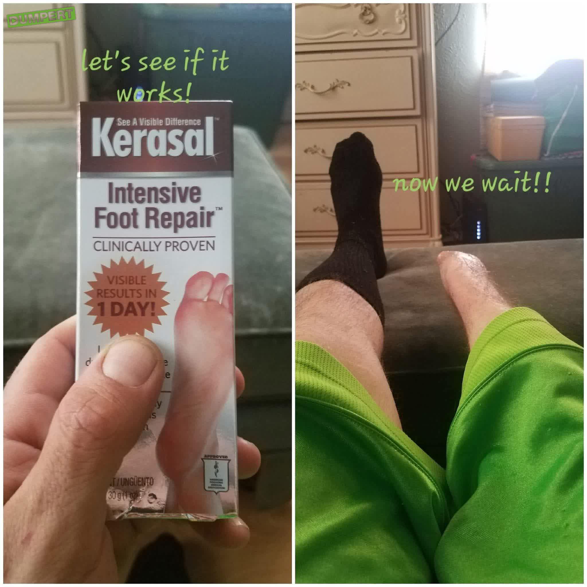 Intensive foot repair