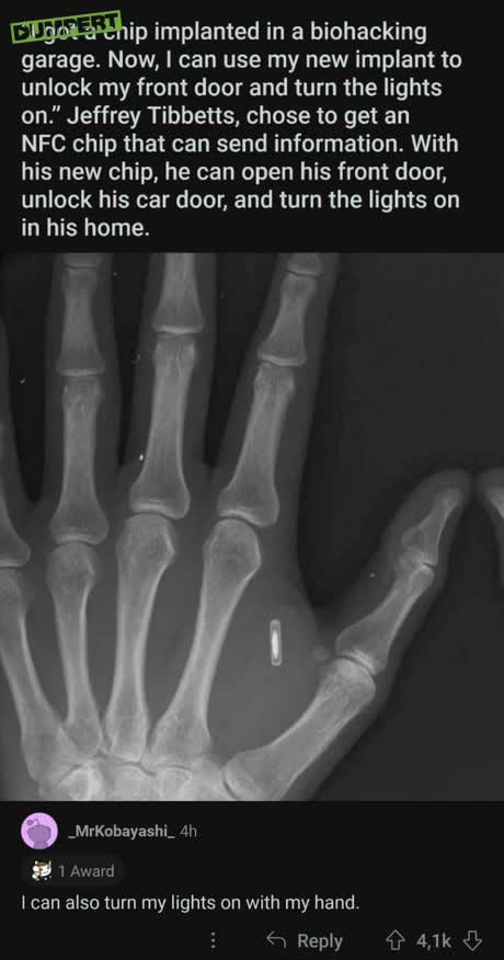 Implantaat in je hand 
