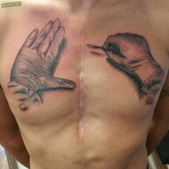 Tattoos bij je littekens