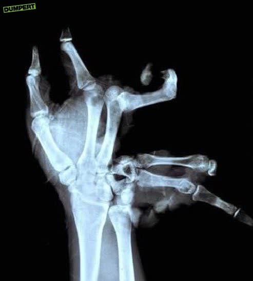 Trump sloopt de hand van Macron