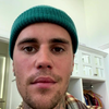Bieber heeft gezichtsverlamming