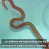 Artsen ontdekken 8cm lange parasiet in vrouwenbrein