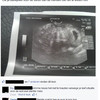 Facebook zwangerschap