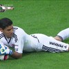 Kleine blessure voor de keeper