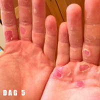 Dag 5